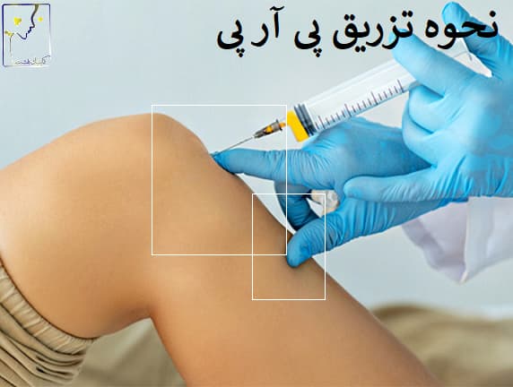 نحوه تزریق پی آر پی