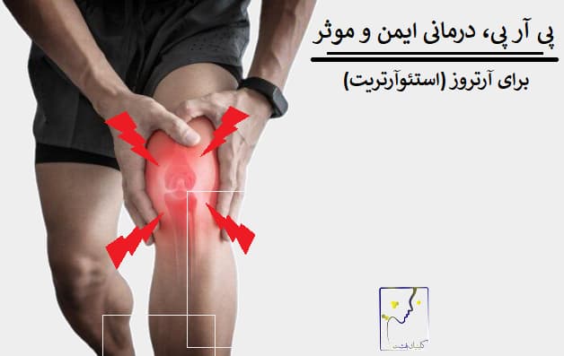 پی آر پی، درمانی ایمن و موثر برای آرتروز (استئوآرتریت)