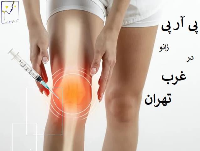 پی آر پی، درمانی ایمن و موثر برای آرتروز