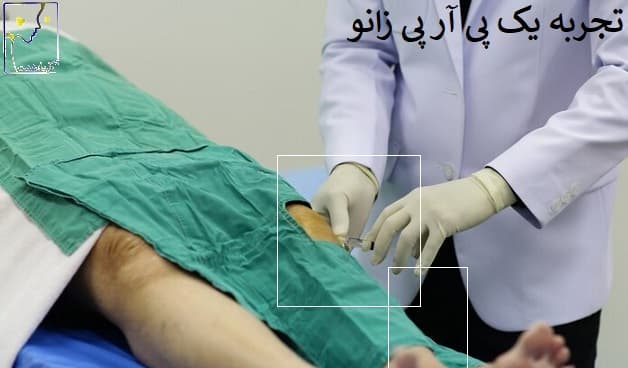 تجربه یک پی آر پی زانو