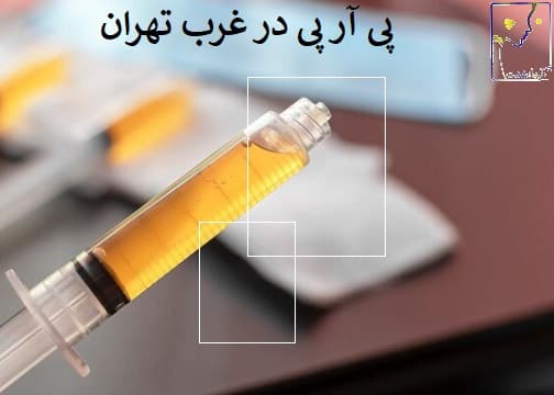پی آر پی در غرب تهران