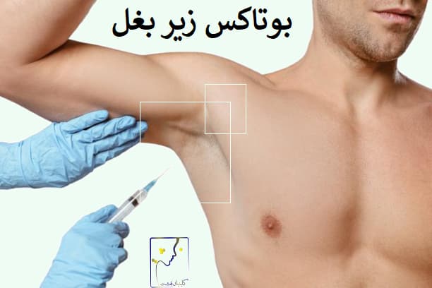 بوتاکس زیر بغل