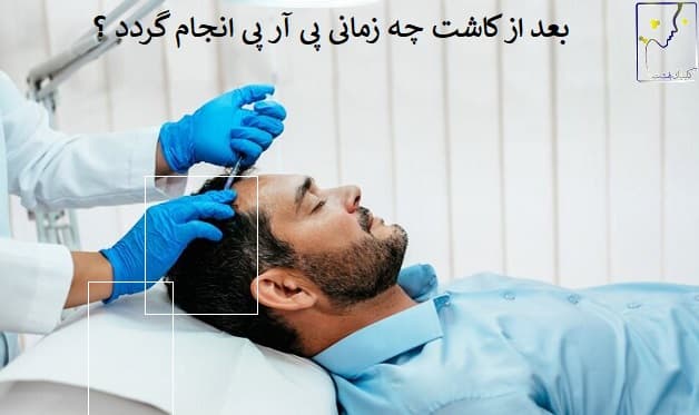 بعد از کاشت چه زمانی پی آر پی انجام گردد ؟
