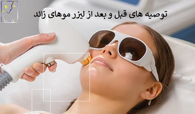 توصیه های قبل و بعد از لیزر موهای زائد