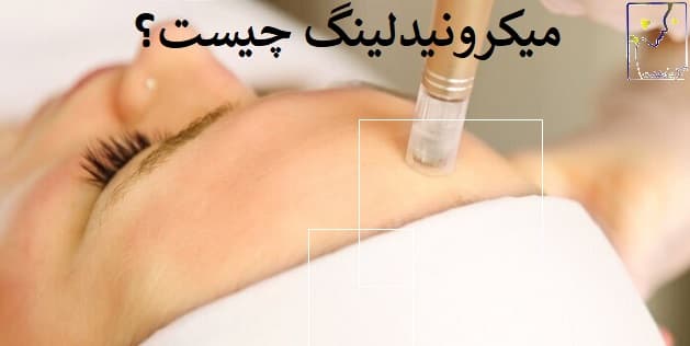 میکرونیدلینگ چیست؟