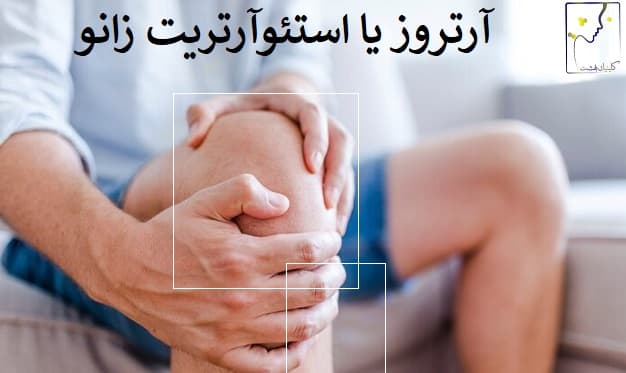 آرتروز یا استئوآرتریت زانو