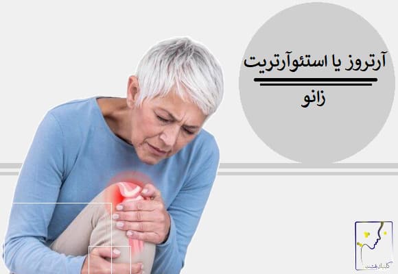 آرتروز یا استئوآرتریت زانو