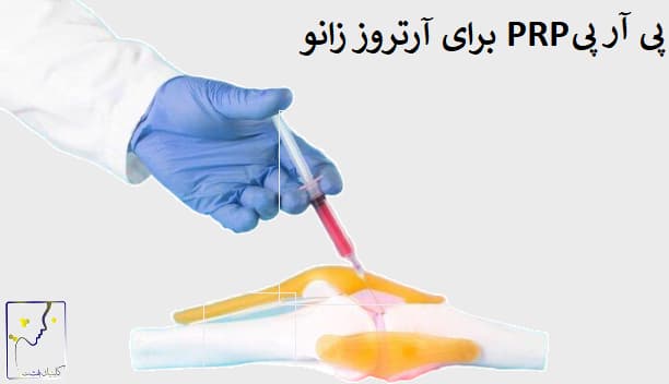 پی آر پی PRP برای آرتروز زانو