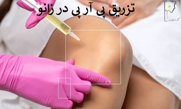 تزریق پی آر پی در زانو