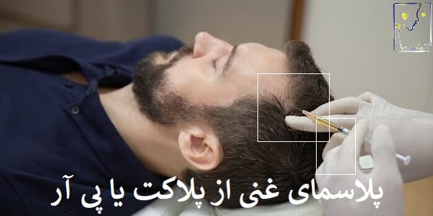 پلاسمای غنی از پلاکت یا پی آر پی