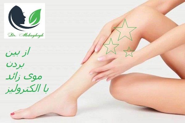 الکترولیز رفع موی زائد