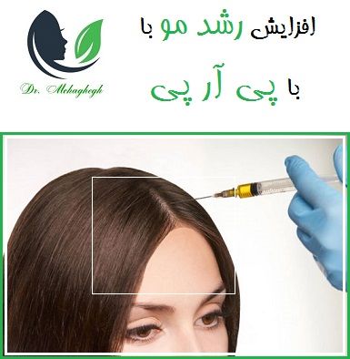 افزایش رشد مو با پی آر پی