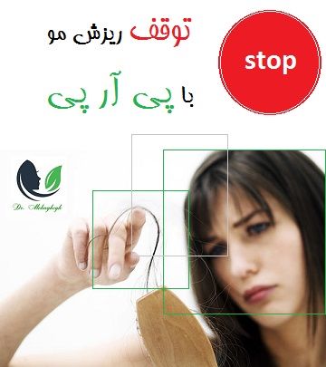 توقف ریزش مو با پی آر پی