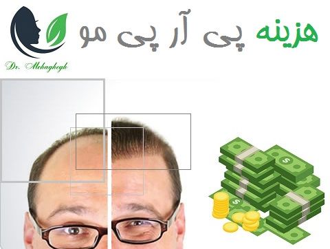 هزینه پی آر پی مو