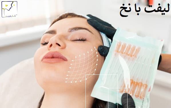 لیفت با نخ