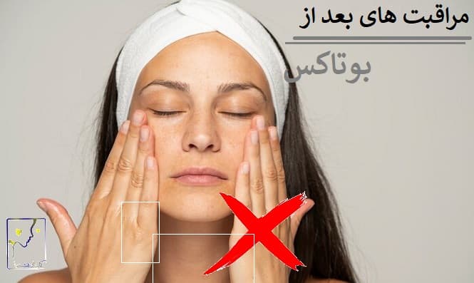 مراقبت های بعد از بوتاکس