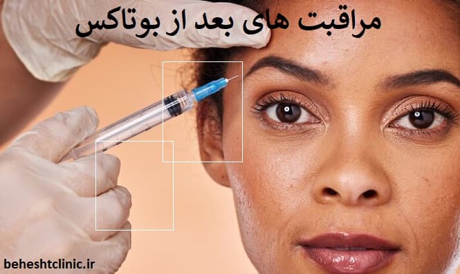 مراقبت های بعد از بوتاکس