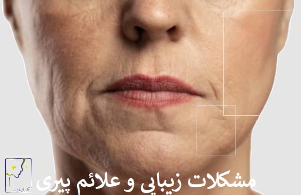 مشکلات زیبایی و علائم پیری