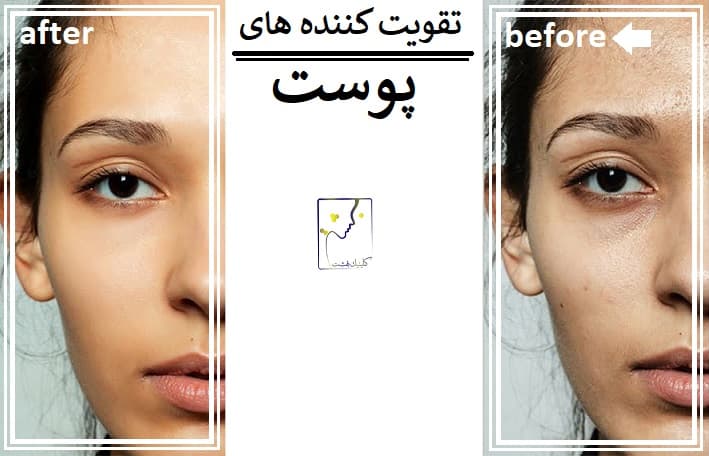 تقویت کننده های پوست
