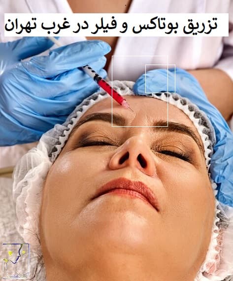 تزریق بوتاکس و فیلر در غرب تهران