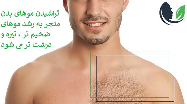 تراشیدن موهای بدن منجر به رشد موهای ضخیم تر ، تیره و درشت تر می شود
