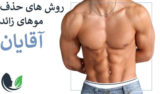روشهای حدف موهای زائد آقایان