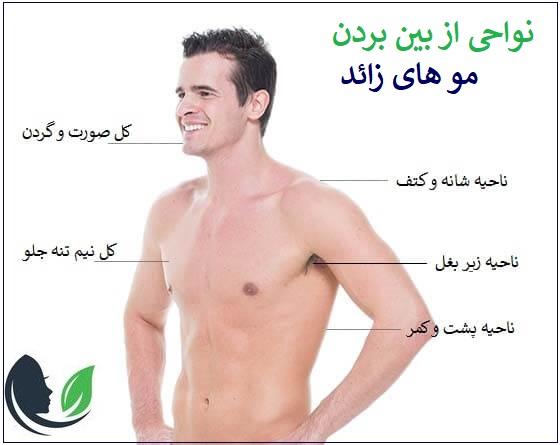 نواحی از بین بردن موهای زائد