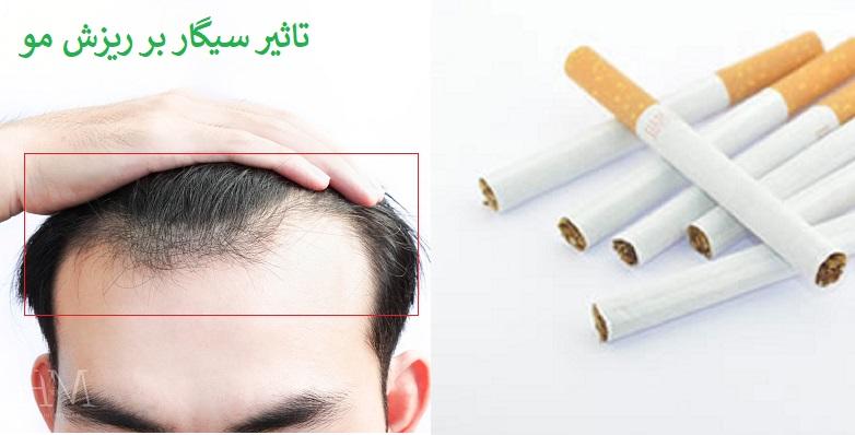 ارتباط بین سیگار کشیدن و ریزش مو