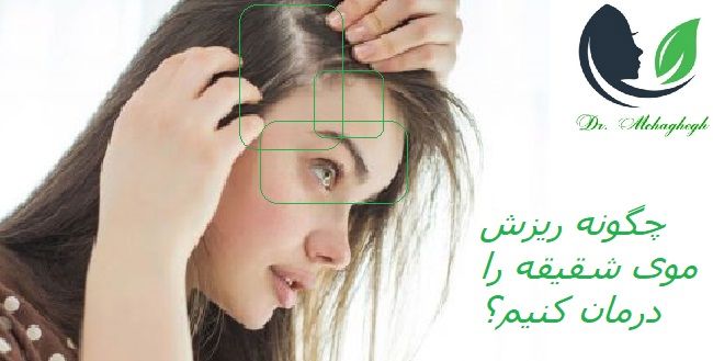 چکونه ریزش موی شقیقه را درمان کنیم؟