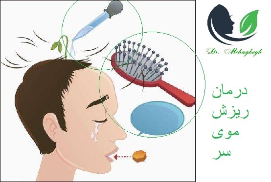 ریزش موهای سر