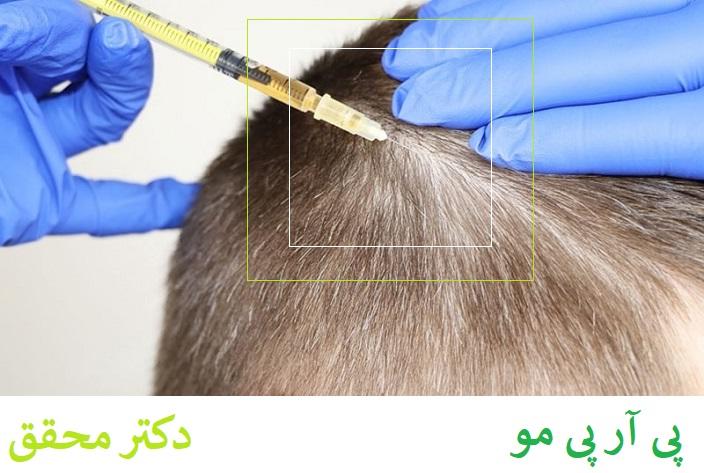 پی ار پی
