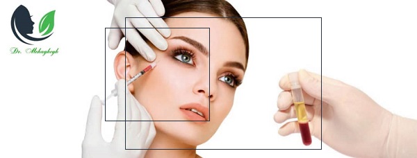 پی آر پی PRP چیست؟