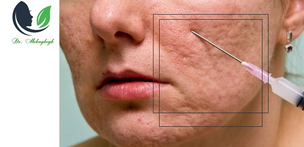 چگونه اسکارهای عمیق را شناسایی کنیم؟