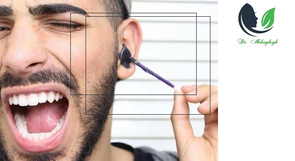 موبر ها