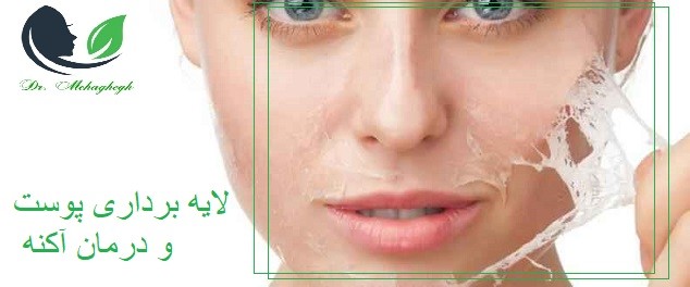 لایه برداری صورت
