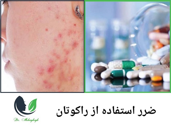 راکوتان چیست و چه ضرر ها و منافعی دارد