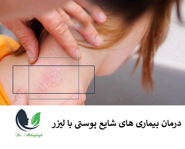 درمان بیماری های شایع پوستی