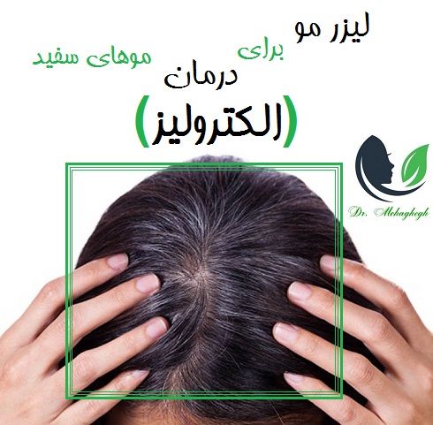 (الکترولیز)
