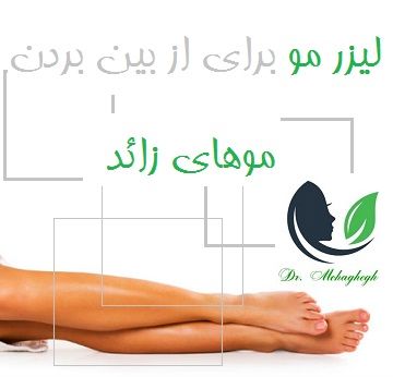لیزر مو برای از بین بردن موهای زائد