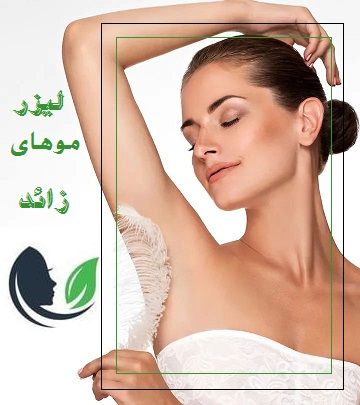 لیزر موهای زائد