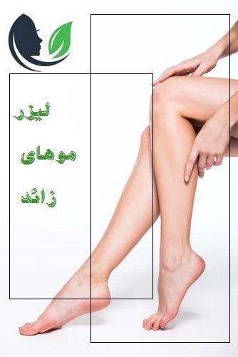 لیزر موهای زائد