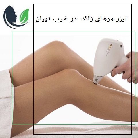 لیزر موهای زائد