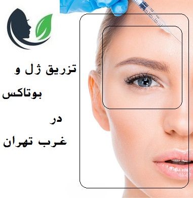 تزریق ژل و بوتاکس غرب تهران