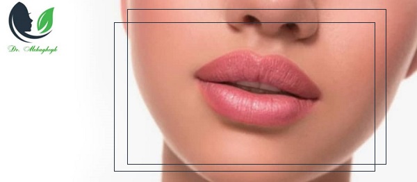 منظور از تزریق ژل یا فیلر لب چیست؟