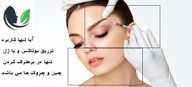 کاربرد های ژل و بوتاکس