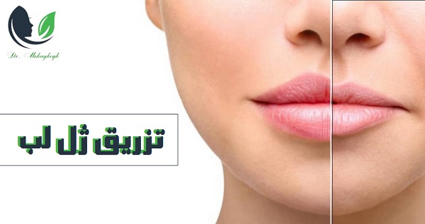 تزریق ژل لب