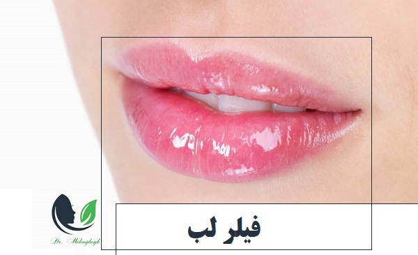 فیلر لب