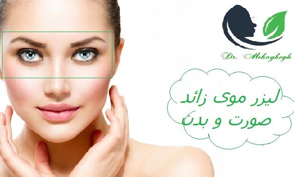 لیزر موهای زائد شرق