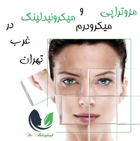 مزوتراپی، میکرودرم و میکرونیدلینگ در غرب تهران