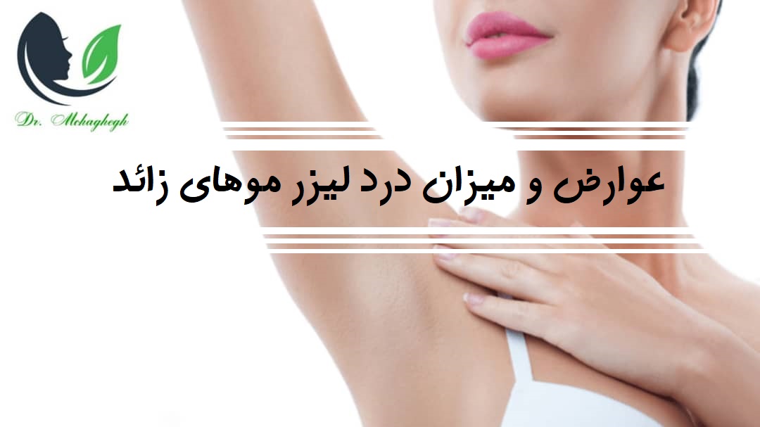 لیزر موهای زائد